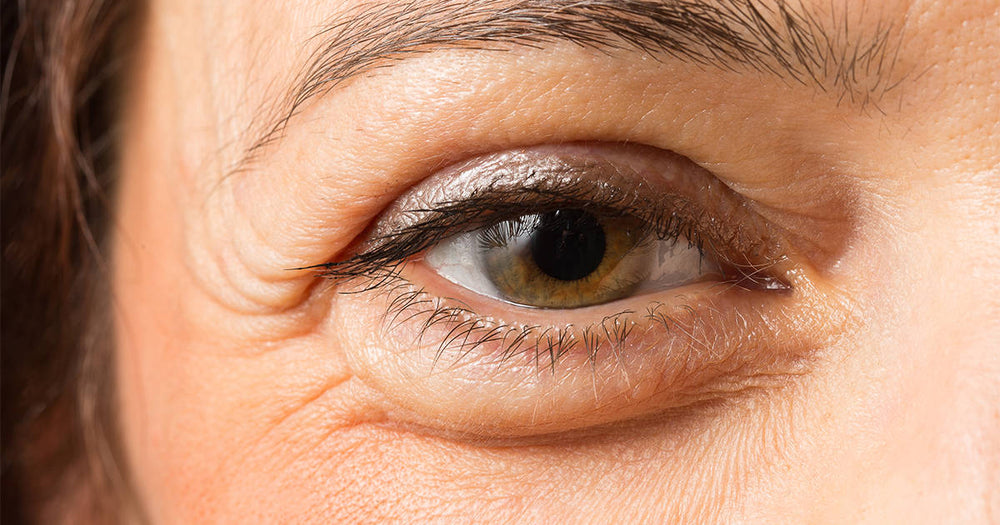 Opgezwollen oog