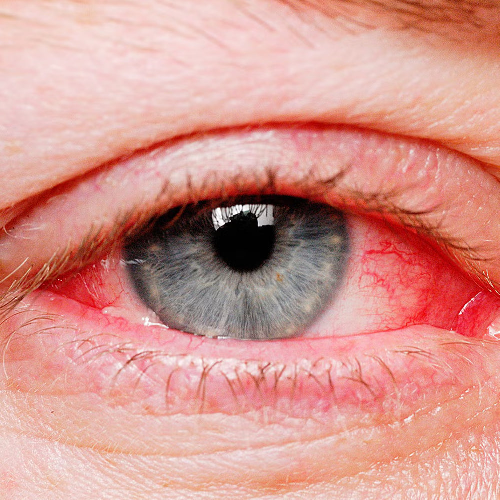 Rood, tranend oog